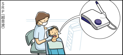 メディカルトリートメントモデルのご案内アニメ SRP（超音波）