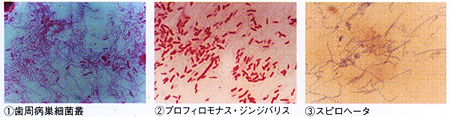 細菌画像1
