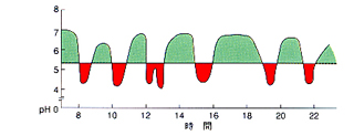 pHの変動パターン3